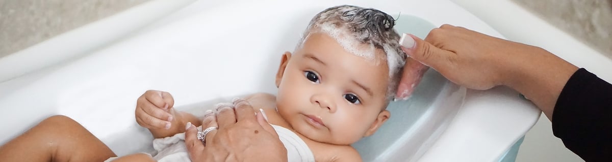 Costra láctea en bebés: preguntas y respuestas